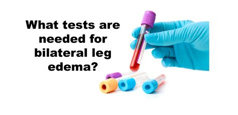 Icd 10 Code For Pitting Edema In Legs
