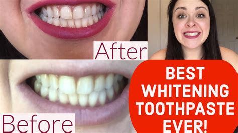 From movie stars to singers and youtube sensations, everyone's got white teeth. BEST WHITENING TOOTHPASTE EVER: REVIEW Crest 3D White Brilliance - YouTube