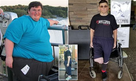 Morbidly Obese Man Sheds 500lbs After Being Warned Hed Be Dead In