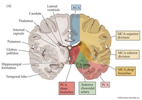 Cerebral Artery Distribution Arteries Internal Capsule Mri Brain