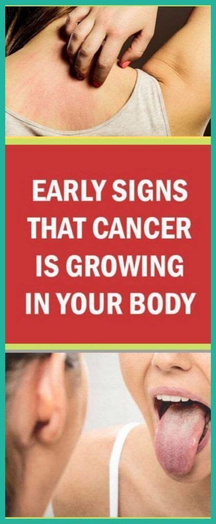 Early Signs That Cancer Is Growing In Your Body Vicks Vaporub Cancer