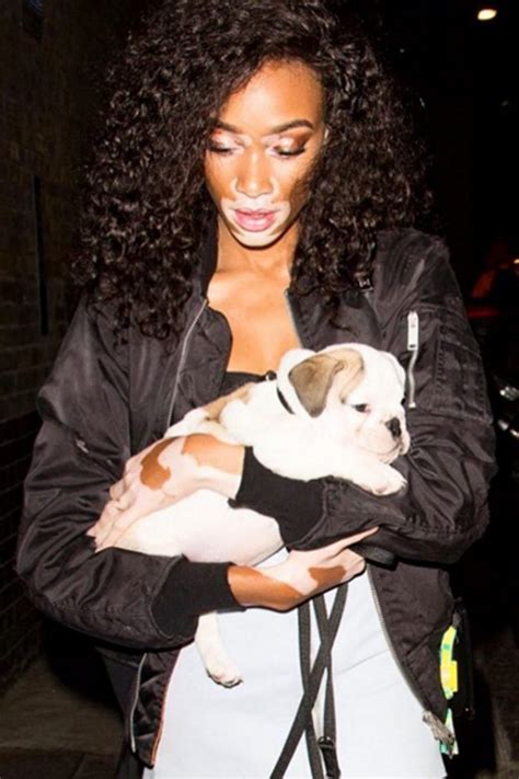 Who Is Winnie Harlow Everything You Need To Know About The Model Ok