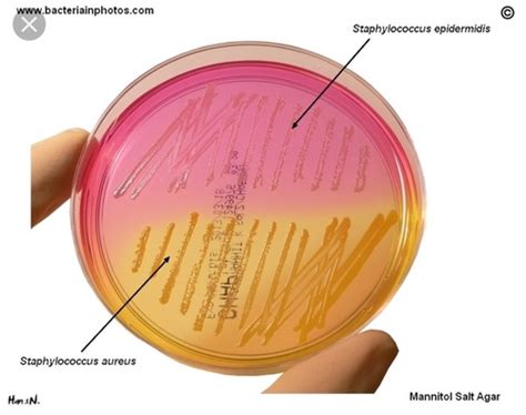 Gram Positive Bacillus Flashcards Quizlet