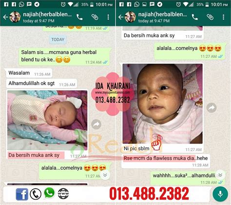 Apa nak buat bila muka bayi naik ruam - Pengedar Shaklee ...