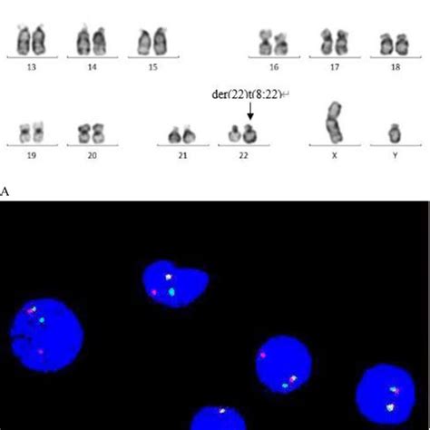 A Chromosome Analysis By G Banding Showing Inserted Karyotype Of Download Scientific Diagram