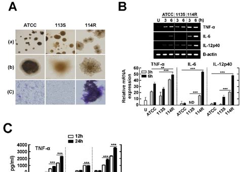 Mycobacterium Scrofulaceum 114r Elicits Cord Formation And Enhanced