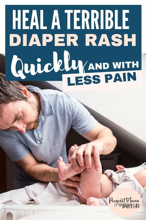 Treat A Bad Diaper Rash Quickly And Naturally Babyrashestreatment