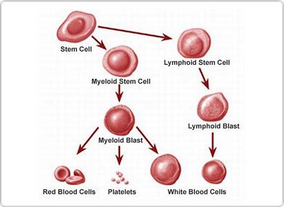 Complete information about leukemia, including signs and symptoms; Leukemia Symptoms | Modern Cancer Hospital Guangzhou, China