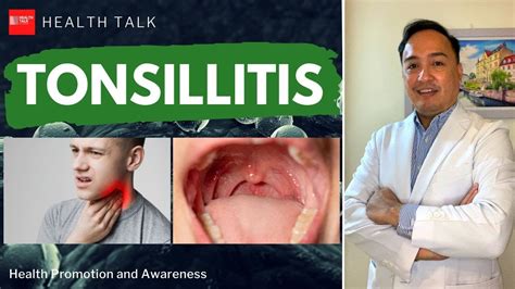 Tonsillitis Symptoms Causes Risk Factors And Complications Youtube