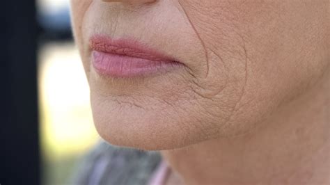 Older Woman Lip Wrinkles Vargas Face And Skin Center