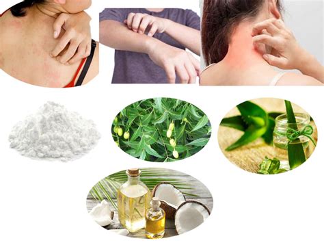 Home Remedies For Itchy And Red Skin Rashes Home Health Beauty Tips