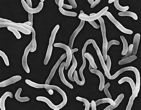 Vibrio Cholerae 6 Photograph By Dennis Kunkel Microscopyscience Photo