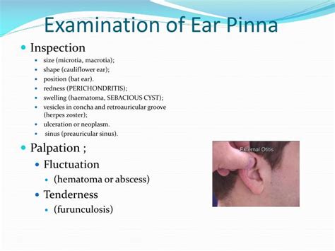 Ppt Introduction To Ent History And Clinical Examination Powerpoint