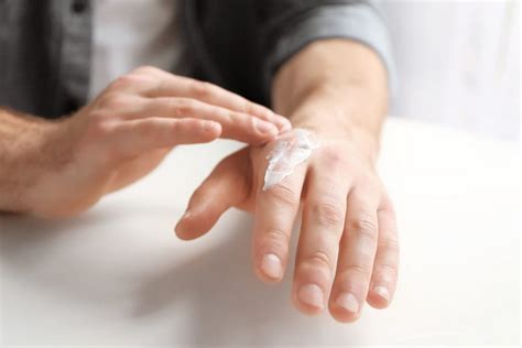 Krim pelembab tidak akan menyembuhkan psoriasis, melainkan hanya mengurangi rasa gatal dan melembabkan kulit yang kering.2. 5 Cara Mengatasi Kulit Kering pada Tangan : Okezone Lifestyle