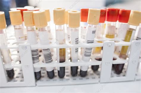 Medical Samples Stock Image F0228864 Science Photo Library
