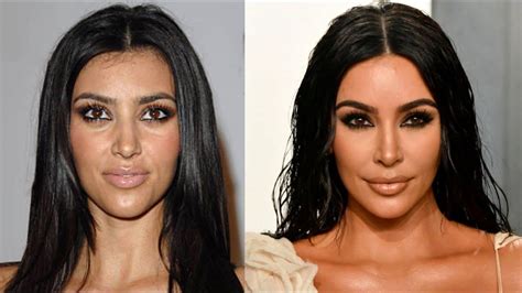 Kim Kardashian Plastic Surgery 2000 2020 Kim Kardashian Surgery