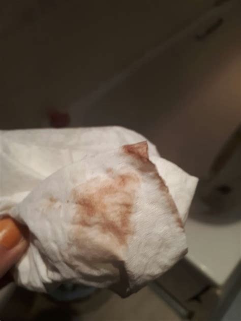 Implantation Bleeding On Toilet Paper