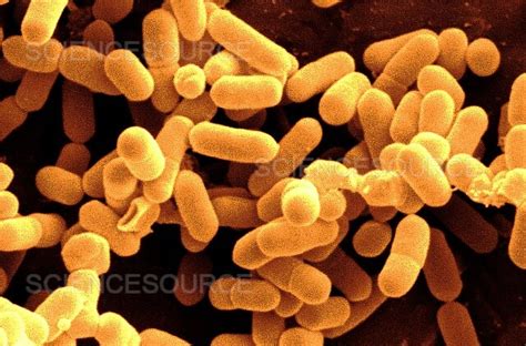 Photograph Listeria Monocytogenes Bacteria Science Source Images