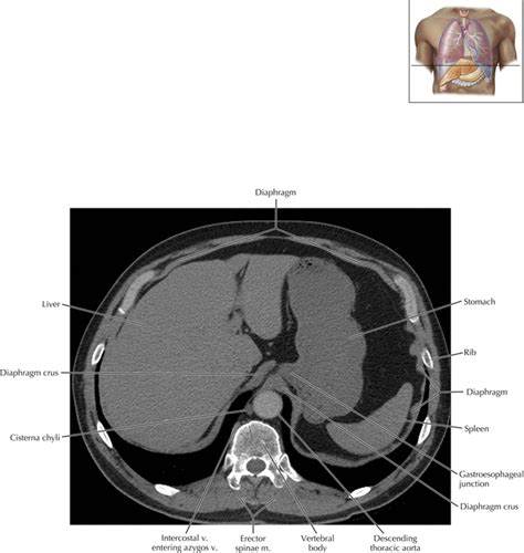 An efferent vessel which p. Cisterna Chyli and Thoracic Duct | Radiology Key