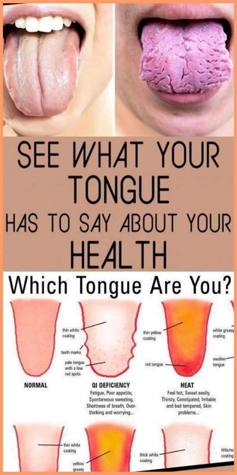 3 Things Your Tongue Is Trying To Reveal About Your Health Health Health Healthy Tongue