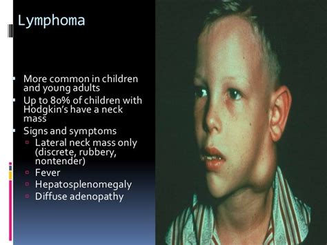 Tumor Symptoms Tumor In Neck Symptoms