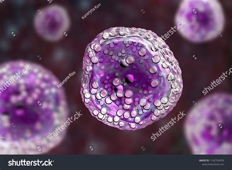 Burkitts Lymphoma Cells Cancer Lymphatic System Stock Illustration