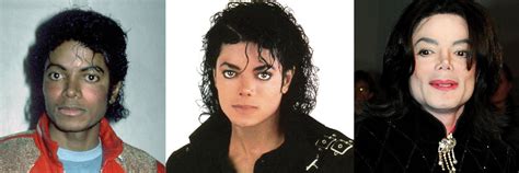How Much Plastic Surgery Did Michael Jackson Actually Have By The