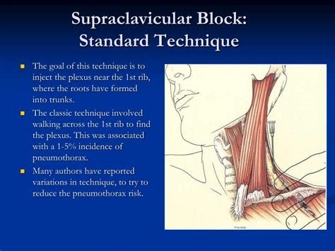 Ppt Supraclavicular And Interscalene Blocks Powerpoint Presentation