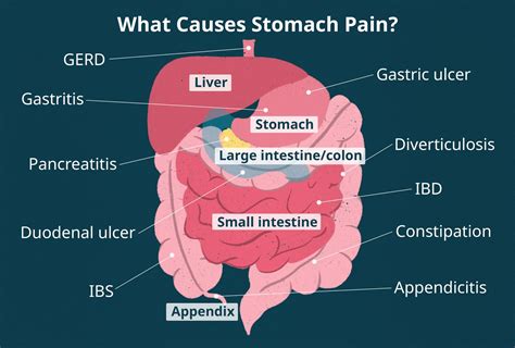 Upper Stomach Diagram