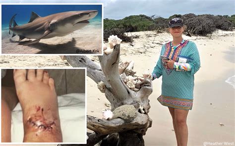 Shark Grabs Florida Snorkelers Foot Teen Bitten By Shark At Cocoa Beach