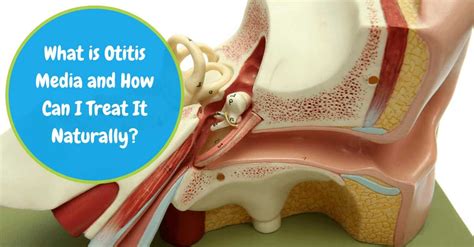 What Is Otitis Media And How Can I Treat It Naturally Otitis Media
