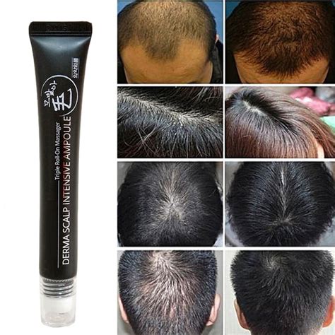 20ml Hair Growth Serum Derma Scalp Intensive Ampoule Triple Roll Massager Fast Regrow Hairline