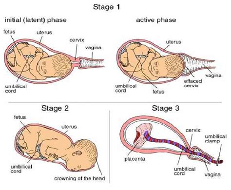 Four Stages Of Labor