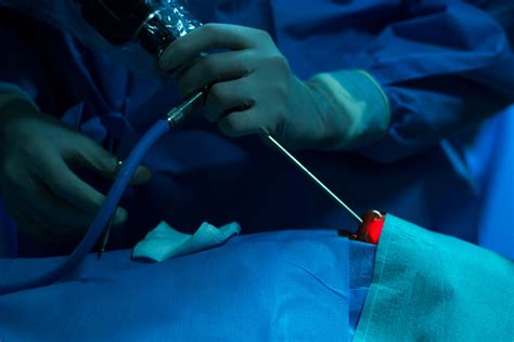 Endoscopic Pituitary Tumor Removal Neurosurgery Doctors In Bangalore