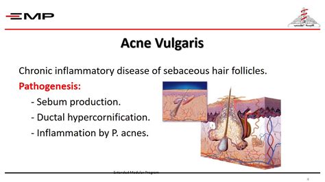 Diseases Of Sweat And Sebaceous Glands Youtube