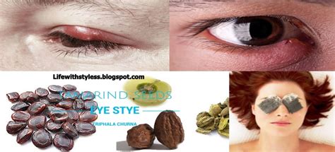 Get Rid Of The Eye Sty With These Effective Home Remedies Life With