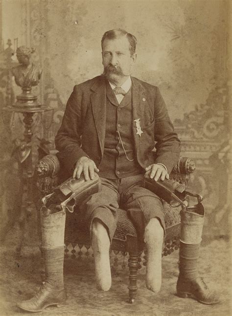 American Civil War Veteran With Prosthetic Legs C 1890 Historycolored