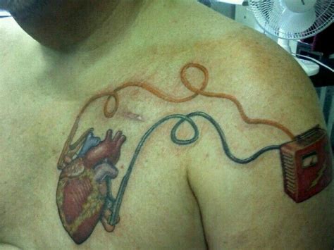 Adjustment of position of pacemaker lead recementing of hip prosthesis. Cool tattoo.. | New tattoos, Medical tattoo, Heartbeat tattoo