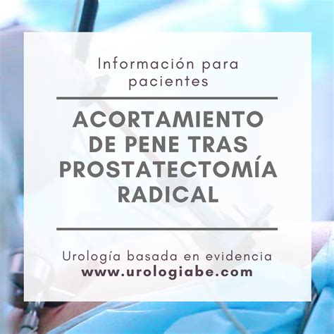 Acortamiento De Pene Tras Prostatectomía Radical Urología Basada En