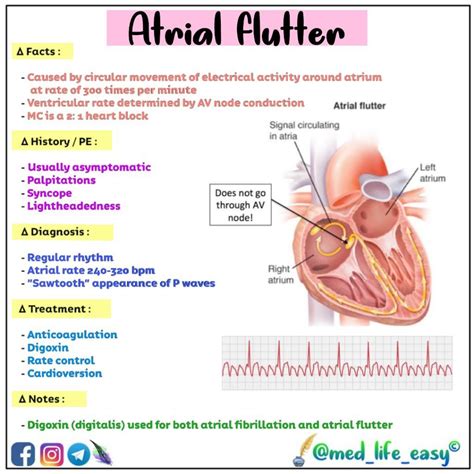 nclex tip atrial fibrillation vs atrial flutter artofit