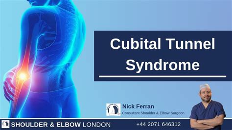 Cubital Tunnel Syndrome Surgery Youtube