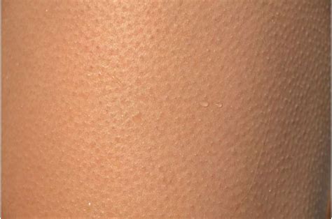 Heres What Happens When You Get Goose Bumps Out Of Nowhere