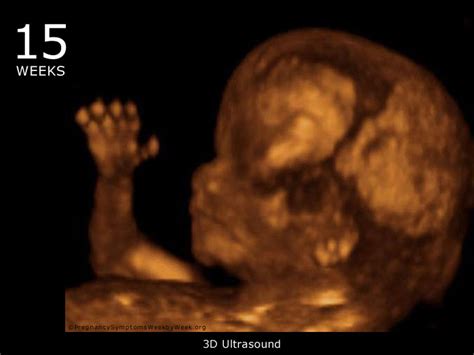 What To Expect In Ultrasound Done At 15 Weeks Pregnant New Kids Center