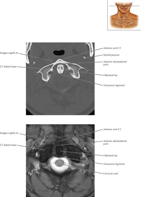 Spine Radiology Key