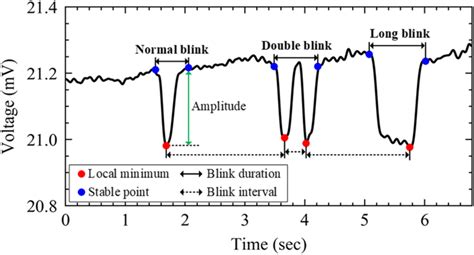 The Typical Eeg Waveforms Of Normal Blink Double Blink And Long Blink