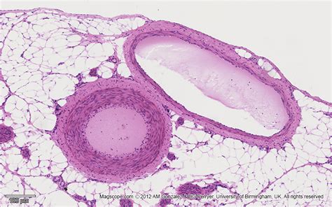 Medium Sized Artery Under Microscope Micropedia