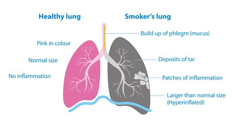 Why Is Smoking Bad For You The Effects Of Smoking Asthma Lung Uk
