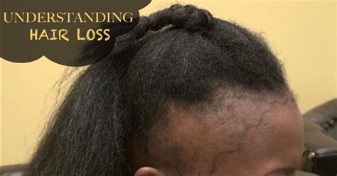 Reasons Why You May Be Experiencing Mild To Severe Hair Loss Black Hair Information