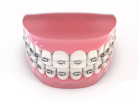 Fake Teeth Set With Braces Digital Art By Allan Swart Pixels