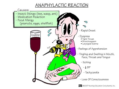 Anaphylactic Reaction Nursing Mnemonics And Tips Medical Surgical